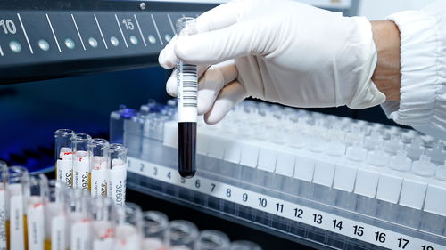 科學技術發展基金資助26項新型冠狀病毒感染科研項目助力技術開發